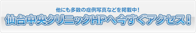 他にも多数の症例写真などを掲載中！仙台中央クリニックHPへ今すぐアクセス！